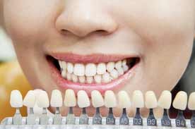 Safe teeth whitening tips